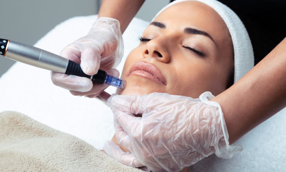 Nano-Needle Facial Nano-Needle Facial